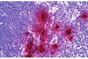 Human Thymus, Myeloid Cells: Formalin-Fixed, Paraffin-Embedded (FFPE) (alpha Defensin 1 Antikörper  (AA 50-63))