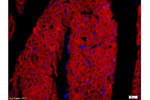 Formalin-fixed and paraffin embedded rat heart tissue labeled with Rabbit Anti-DOG-1/TMEM16A Polyclonal Antibody, Unconjugated at 1:200 followed by conjugation to the secondary antibody and DAB staining. (ANO1 Antikörper  (AA 151-250))