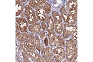 Immunohistochemical staining of human kidney shows moderate cytoplasmic positivity in tubular cells.