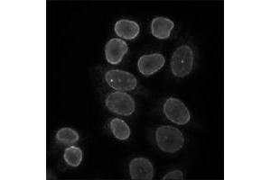 Indirect immunofluorescence staining of HeLa cells with Lbr polyclonal antibody .