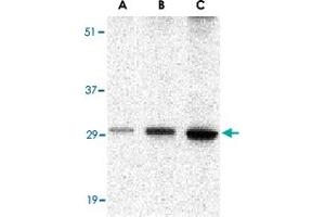 Western blot analysis of BCL2A1 in human kidney tissue lysate with BCL2A1 polyclonal antibody  at (A) 0. (BCL2A1 Antikörper  (C-Term))