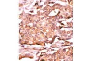 Image no. 1 for anti-RAD9 Homolog A (S. Pombe) (RAD9A) (pSer272) antibody (ABIN358200)