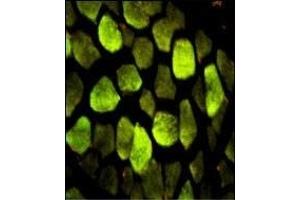Immunofluorescence analysis of ATP5O Antibody (N-term) with paraffin-embedded human skeletal muscle.