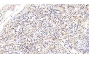 Detection of IL17 in Porcine Small intestine Tissue using Monoclonal Antibody to Interleukin 17 (IL17) (IL-17 Antikörper  (AA 25-153))