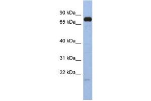 WB Suggested Anti-SIM1 Antibody Titration:  0. (SIM1 Antikörper  (N-Term))