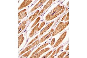 Antibody staining PDK4 in human heart tissue sections by Immunohistochemistry (IHC-P - paraformaldehyde-fixed, paraffin-embedded sections). (PDK4 Antikörper  (C-Term))