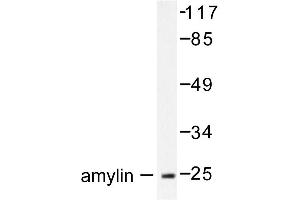 Image no. 1 for anti-Islet Amyloid Polypeptide (IAPP) antibody (ABIN271869) (Amylin/DAP Antikörper)