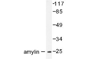 Image no. 1 for anti-Islet Amyloid Polypeptide (IAPP) antibody (ABIN271869) (Amylin/DAP Antikörper)
