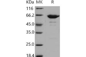 Western Blotting (WB) image for Leukotriene A4 Hydrolase (LTA4H) (Active) protein (His tag) (ABIN7320340)