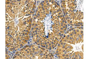 ABIN6259321 and ABIN6274774 at 1/100 staining Mouse testis tissue by IHC-P. (RPL26L Antikörper  (C-Term))