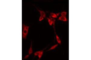 ABIN6267322 staining NIH-3T3 by IF/ICC. (EIF4E Antikörper  (pSer209))