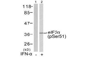 Image no. 1 for anti-Eukaryotic Translation Initiation Factor 2 Subunit 1 (EIF2S1) (pSer51) antibody (ABIN197047) (EIF2S1 Antikörper  (pSer51))