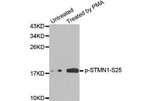 Western blot analysis of extracts from Jurkat cells, using Phospho-STMN1-S25 antibody. (Stathmin 1 Antikörper  (pSer25))