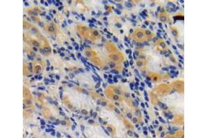Used in DAB staining on fromalin fixed paraffin-embedded stomach tissue (SIRT3 Antikörper  (AA 126-399))