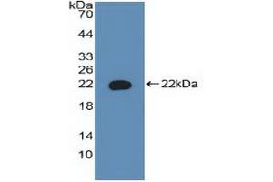 Detection of Recombinant BAD, Human using Polyclonal Antibody to Bcl2 Associated Death Promoter (BAD) (BAD Antikörper  (AA 1-168))