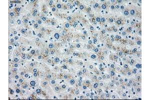 Image no. 2 for anti-Checkpoint Kinase 2 (CHEK2) antibody (ABIN1497500) (CHEK2 Antikörper)