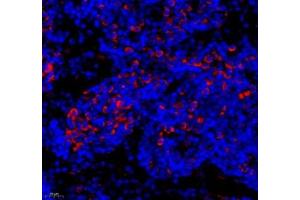 Immunofluorescence (Paraffin-embedded Sections) (IF (p)) image for anti-Microtubule-Associated Protein 7 (MAP7) antibody (ABIN7074621)