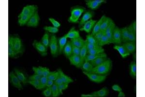 Immunofluorescence staining of HepG2 cells with ABIN7145359 at 1:66, counter-stained with DAPI.