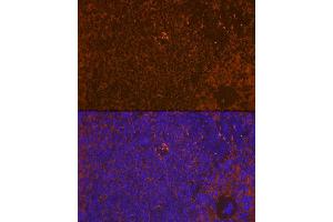 Immunofluorescence analysis of rat spleen using WASP Rabbit mAb (ABIN7271381) at dilution of 1:100 (40x lens). (WASP Antikörper)