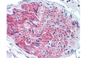 Immunohistochemistry (IHC) image for anti-Purinergic Receptor P2X, Ligand-Gated Ion Channel, 7 (P2RX7) (Internal Region) antibody (ABIN1049197)