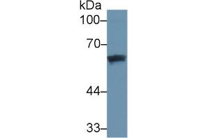 Detection of DBP in Human Lung lysate using Monoclonal Antibody to Vitamin D Binding Protein (DBP) (Vitamin D-Binding Protein Antikörper  (AA 209-401))