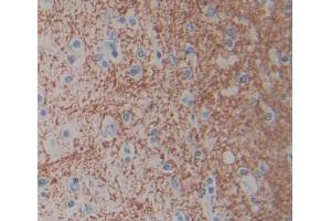 Used in DAB staining on fromalin fixed paraffin- embedded brain tissue (Cnpase Antikörper  (AA 186-421))