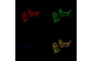 ABIN7093102 and ABIN7097256 staining Hela cells(heat shock treatment) by IF/ICC.