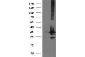 Image no. 1 for anti-Phenylethanolamine N-Methyltransferase (PNMT) antibody (ABIN1500306) (PNMT Antikörper)