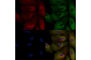 ABIN6265394 and ABIN6266638 staining  cells by IF/ICC. (Synaptophysin Antikörper  (Internal Region))