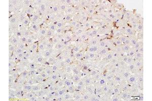 Formalin-fixed and paraffin embedded rat liver tissue labeled with Rabbit Anti-phospho-CD32B(Tyr292) Polyclonal Antibody at 1:200 followed by conjugation to the secondary antibody and DAB staining. (FCGR2B Antikörper  (pTyr292))