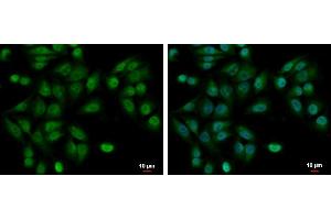 ICC/IF Image UBE2A antibody detects UBE2A protein at cytoplasm and nucleus by immunofluorescent analysis. (UBE2A Antikörper)