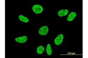 Immunofluorescence of monoclonal antibody to FLJ20097 on HeLa cell. (Syndetin/VPS50 Antikörper  (AA 862-964))