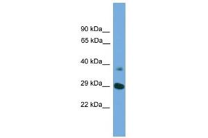 WB Suggested Anti-ATG16L1 Antibody Titration: 0.