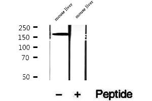 Western blot analysis of extracts of mouse liver tissue, using CPS1 antibody. (CPS1 Antikörper)