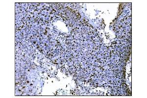 IHC analysis of Ki67 using anti-Ki67 antibody (ABIN7601100).