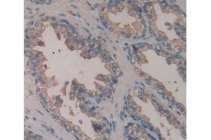 Used in DAB staining on fromalin fixed paraffin- embedded prostate gland tissue (PADI1 Antikörper  (AA 298-556))