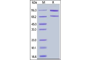 Cynomolgus Complement C5, His Tag on  under reducing (R) condition. (C5 Protein (AA 19-1676) (His tag))