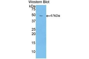 Detection of Recombinant LTbR, Mouse using Polyclonal Antibody to Lymphotoxin Beta Receptor (LTbR) (LTBR Antikörper  (AA 128-395))