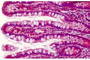 Human Small Intestine: Formalin-Fixed, Paraffin-Embedded (FFPE) (PDCD5 Antikörper  (C-Term))