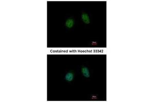 ICC/IF Image Immunofluorescence analysis of paraformaldehyde-fixed HeLa, using Annexin V, antibody at 1:500 dilution. (Annexin V Antikörper)