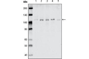 Western blot analysis using EhpB1 mouse mAb against MDA-MB-468 (1), MDA-MB-453 (2), MCF-7 (3), T47D (4) and SKBR-3 (5) cell lysate. (EhpB1 (AA 19-133) Antikörper)