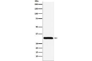 Western blot analysis of PSME1 expression in Jurkat cell lysate.