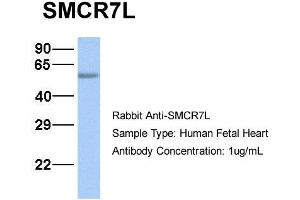 Host:  Rabbit  Target Name:  SMCR7L  Sample Type:  Human Fetal Heart  Antibody Dilution:  1. (SMCR7L Antikörper  (N-Term))