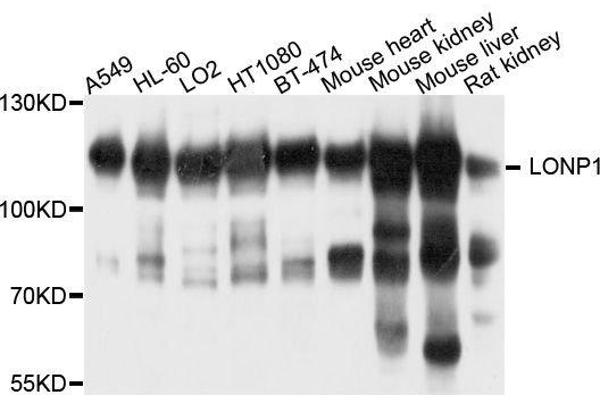 LONP1 Antikörper  (AA 120-400)