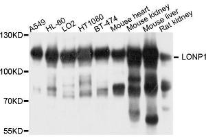 Western blot analysis of extracts of various cell lines, using LONP1 antibody. (LONP1 Antikörper  (AA 120-400))
