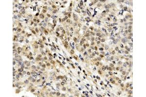 IHC analysis of MNT using anti-MNT antibody (ABIN7601555).