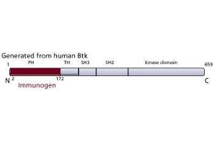 Image no. 2 for anti-Bruton Agammaglobulinemia tyrosine Kinase (BTK) (AA 2-172), (N-Term) antibody (ABIN968375) (BTK Antikörper  (N-Term))