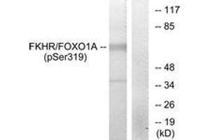 Western blot analysis of extracts from HeLa cells treated with EGF, using FKHR (Phospho-Ser319) Antibody. (FOXO1 Antikörper  (pSer319))
