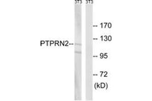 Western blot analysis of extracts from NIH-3T3 cells, using PTPRN2 Antibody. (PTPRN2 Antikörper  (AA 206-255))