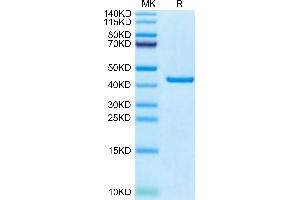 Canine PKA on Tris-Bis PAGE under reduced condition. (PKA Protein (AA 2-350) (His tag))